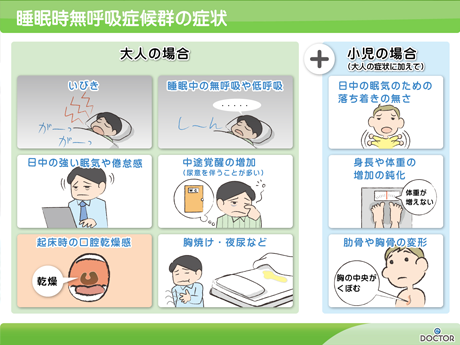 睡眠時無呼吸症候群の症状