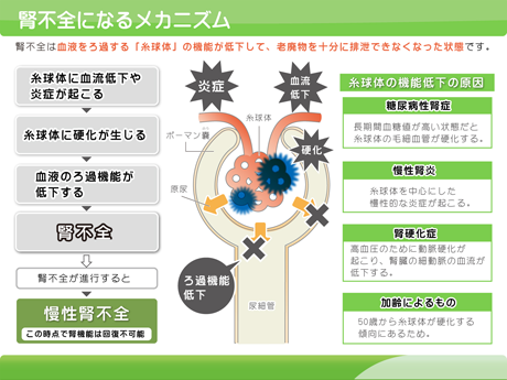 腎不全になるメカニズム